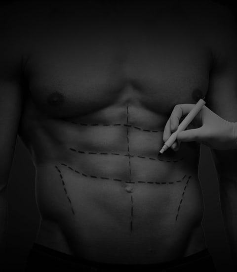 Abdominal Sculpting in Pasadena, CA