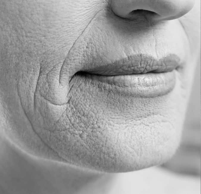 Air before patient photo