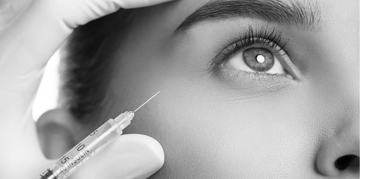 How Long Does Botox Last? Unlock the Secret to Lasting Results