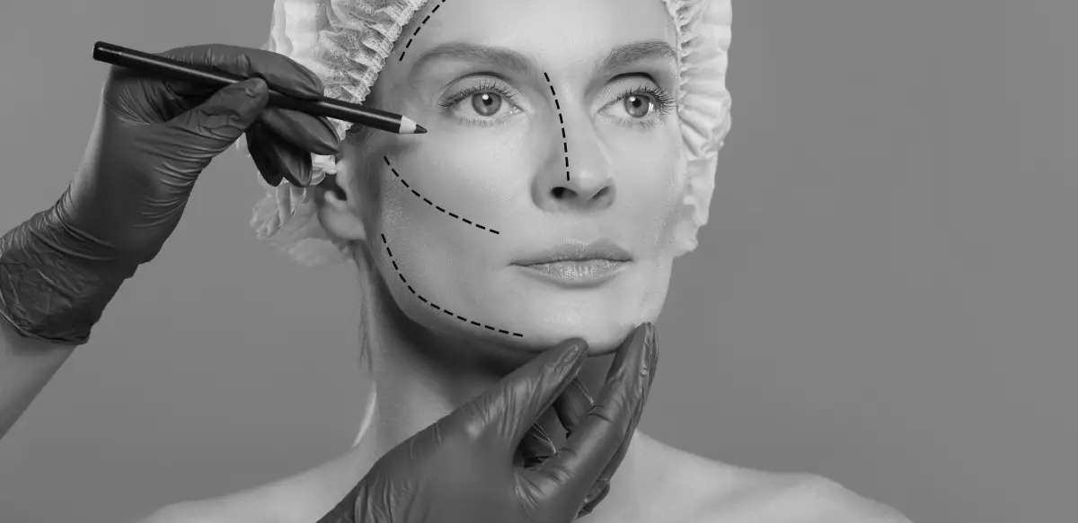 What is an Eye Lift and Can it Make You Look Younger?